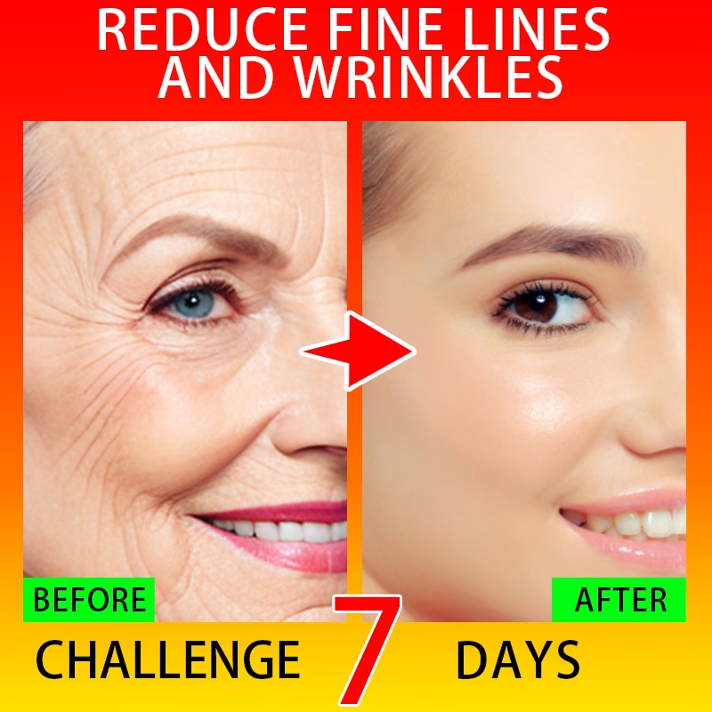 Effective Anti-Ageing And Anti-Wrinkle Facial Serum To Remove Facial Wrinkles Fine Lines Around The Eyes Crow&#39;s Feet Neck Wrinkl