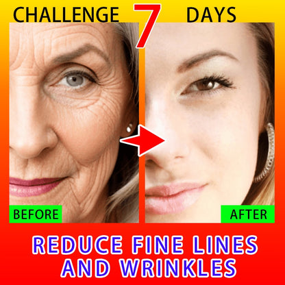 Effective Anti-Ageing And Anti-Wrinkle Facial Serum To Remove Facial Wrinkles Fine Lines Around The Eyes Crow&#39;s Feet Neck Wrinkl